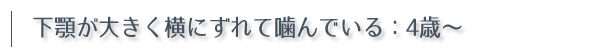 下顎が大きく横にずれて噛んでいる：4歳〜
