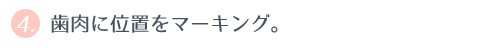 ④ 歯肉に位置をマーキング。