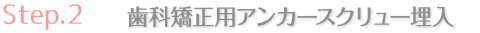 歯科矯正用アンカースクリュー埋入